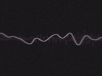 Soundwaves on a black background and a small q in the right corner of the image